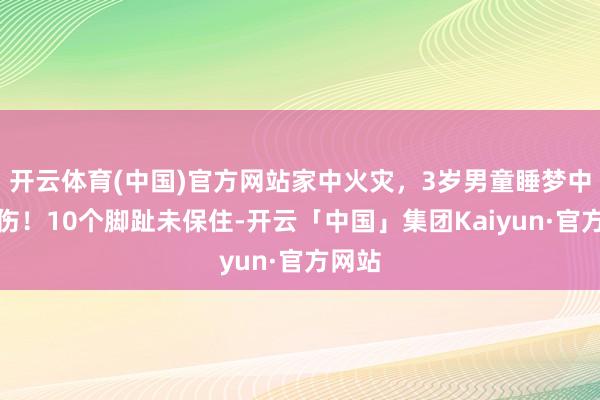 开云体育(中国)官方网站家中火灾,3岁男童睡梦中被烧伤!10个脚趾未保住-开云「中国」集团Kaiyun·官方网站