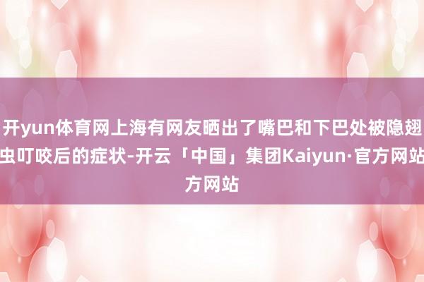 开yun体育网上海有网友晒出了嘴巴和下巴处被隐翅虫叮咬后的症状-开云「中国」集团Kaiyun·官方网站